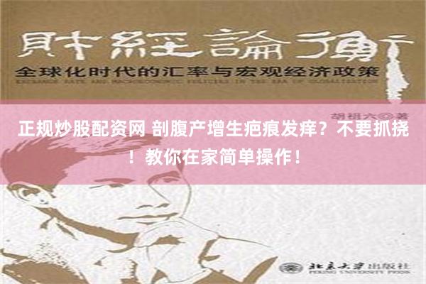 正规炒股配资网 剖腹产增生疤痕发痒？不要抓挠！教你在家简单操作！